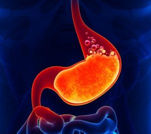哪些原因容易引发肠胃疾病？